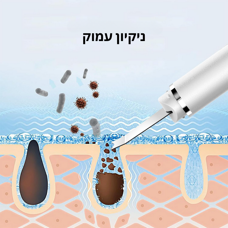 מכשיר לניקיון שחורים ושומניות